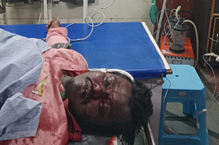 road accident: రోడ్డు ప్రమాదంలో గాయపడిన దివ్యాంగుడు మృతి